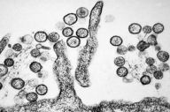 Bukan Virus Baru, Hantavirus...