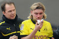 Schmelzer patah tulang...
