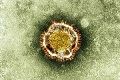 Virus mirip SARS dapat...