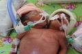 Rekening peduli bayi...