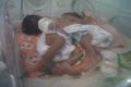Bayi kembar siam lahir...