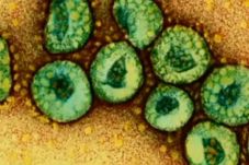 3 pasien suspect MERS...