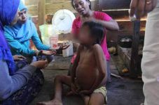Bocah Tanpa Anus akan...
