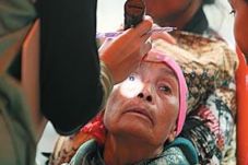 Terkena Katarak, Ratusan...