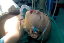 Sumpit Masuk ke Mulut...