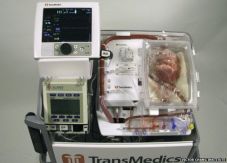 Transplantasi dengan...