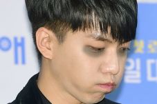 Kantung Mata Lee Seung...