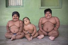 Tiga Anak Kelewat Gendut,...