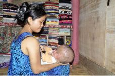 Bayi Penderita Hydrocephalus...
