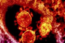 Virus MERS untuk Pertama...