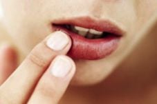 Cara Mengatasi Bibir...
