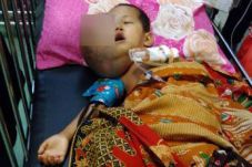 Balita Ini Derita Tumor...