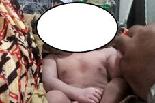 Lahir dengan Dua Kepala,...