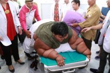 Bocah Obesitas asal...