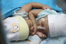 RSHS Rawat Bayi Kembar...