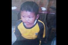 Penuh Luka di Tubuh...