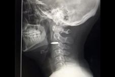 Wartawan Ini Masih Hidup...