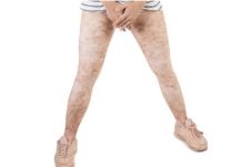 Unik! Leging Ini Berbulu