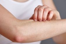 Penyakit Kulit Psoriasis...