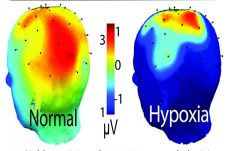 Waspadai Hypoxia, Penyakit...