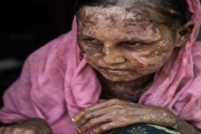 Sekujur Tubuh Terbakar,...