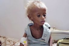 PBB: 400 Ribu Anak-anak...