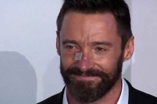 Hugh Jackman, Berjuang...