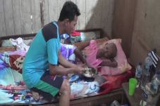 Idap Kanker Tulang,...