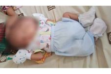 Tolong! Bayi Berwajah...