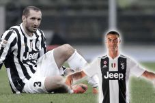 Chiellini Masih Belum...