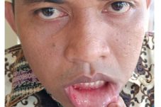 Dipukul Oknum Dewan,...