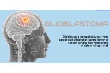 Operasi Glioblastoma...