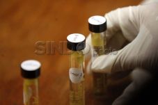 Hasil Tes Urine Artis...