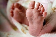 Bayi dengan Dua Kepala...
