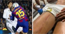Varane Dapat Tekel Horor,...