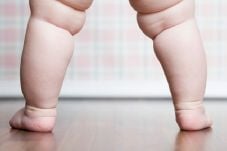 3 Cara Mengurangi Obesitas...