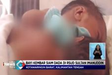 Tangani Bayi Kembar...