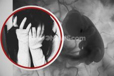 Polisi Temukan 903 Janin...