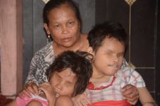Derita Kakak Adik Buta...