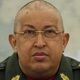 Chavez sukses jalani radioterapi kanker