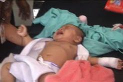 Sakit jiwa, Ibu kandung potong tangan bayi