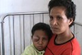 Diduga ditampar guru, bocah SD kena tumor mata