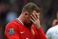 Rooney butuh rambut baru (lagi)