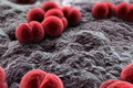 Korban tewas akibat meningitis di AS menjadi 15