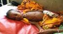 Makanan pencegah gizi buruk tidak harus mahal