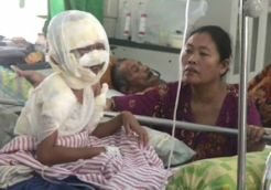 Berlari mau pipis, bocah 7 tahun tersiram sayur mendidih