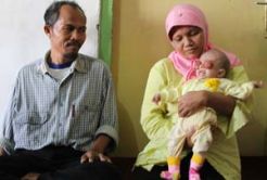 Sidik, si bayi dengan benjolan di mata