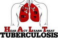 175 jiwa meninggal perhari karena TB