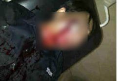 Liput demo BBM, Jurnalis Trans 7 terkena tembakan