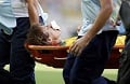 Meski hidung patah, David Luiz ingin terus bermain